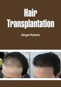 在飛比找樂天市場購物網優惠-【電子書】Hair Transplantation