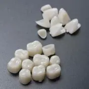 60pcs Resin Teeth Dentistry Dental Temporary Crown Material for Anterior & Molar