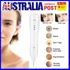 Laser Freckle Removal Machine Skin Mole Dark Spot Face Wart Tag Remover Pen AUS