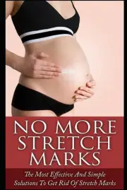 No More Stretch Marks: The Most Effective and Simple Solutions to Get Rid of Str
