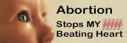 Abortion Stops My Beating Heart Pro-Life Bumper Sticker