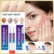 12 Hours Wart Remover Pen Skin Tag Mole Remover Eliminate Foot Corn Warts Unisex
