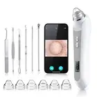 Blackhead Remover Vacuum, Black Head Remover for Face with Camera, Pore Vacuum f