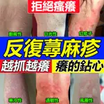 【瘙癢救星】過敏性皮炎止癢膏抗菌消炎乳膏慢性蕁麻疹乳膏身上幹癢紅疙瘩濕疹百草膏蕁麻疹軟膏