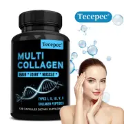 Multi Collagen Capsules,Promotes Digestion & Gut Health,Strong Skin,Hair & Nails