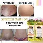 Stretch Marks & Scars Oil – 100% Natural, 600ml