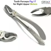 Fig #17 Dental Extraction Forceps | Precision Tool for Upper Molar Removal