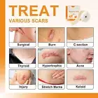Silicone Scars Removal Sheets for Surgery, C-section, Burn, Acne, Keloid Thyroid