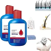 Nipori Shampoo, Nipori Shampoo Selenium, Gentle Hair Care, Refreshing and Non-greasy, Helps Control Oil and Reduce Dandruff (2)
