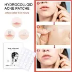 Invisible Acne Removing Patch to Mask Acne Acne Tea Salicylic Acid~ Tree Ne P7U8