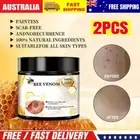 Bee-Venom Skin Treatments Cream Natural Herbal Effective Skin-Tag Removal Cream