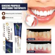 Ginseng Propolis Conservation Toothpaste，Loose Teeth Toothpaste Care 2024 R3G2