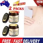 2pcs Bee Venom Skin Treatment Cream Tag Removal Cream For Body Care Skins Wart