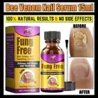 Toenail Fungus support nail fungus healthy nail beauty quick serum 15ml AUS FS