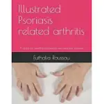 ILLUSTRATED PSORIASIS RELATED ARTHRITIS: A GUIDE FOR HEALTH PROFESSIONALS AND PSORIASIS SUFFERERS