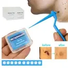 Rubber Bands Skin Tag Remover Face Care Skin Tag Removal Kit Mole Wart Tool