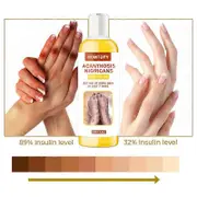 Extra Strength Yellow Peeling Oil Knuckles Skin Whitening Dead Skin Exfoliating Dark Spots Oil 100ml/30ml B