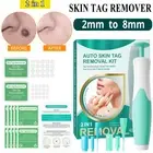 2in1 Painless Skin Tag Mole Wart Removal Kit Auto SKIN TAG Bands Remover Natural