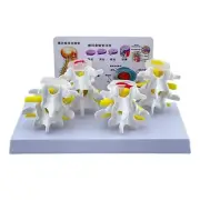 Human Lumbar Vertebrae Model Nursing Model Human Skeleton Model Medicals Model
