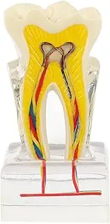 Alipis Teaching Model Demonstration Teeth Model with Anatomical Structure for Study Teaching and Practice Educational Settings