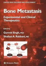 Bone Metastasis by Gurmit Singh (English) Paperback Book