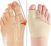 2 Pcs Beige Bunion Corrector Sock - 2023 New Orthoes Bunion Relief Socks Women ＆ Men, Comfortable Orthopedic Bunion Toe Corrector Big Toe Straightener Brace, Hallux Valgus Corrector Bunion Pads