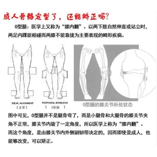 兒童X形腿O型腿矯正帶身姿糾正直腿型彎曲內外八字綁腿帶神器成人