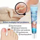 Nail Fungus Fungal Removal Cream Treatment Care Onychomycosis Infection