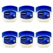 6x Vaseline 250ml Pure Petroleum Jelly Jar Hand/Face/Body Moisturiser Orginal