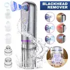 Electric Blackhead Remover Vacuum Pore Cleaner Acne Comedone Extractor Face Pore