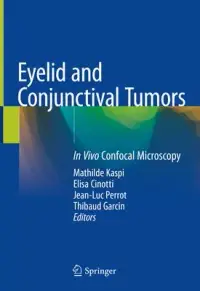 在飛比找博客來優惠-Eyelid and Conjunctival Tumors