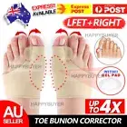 1/2Pairs Toe Bunion Splint Straightener Corrector Hallux Valgus Foot Separator
