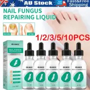30ml Kerassentials for Toenail Fungus Kerassentials Toenail Fungus Treatment Oil