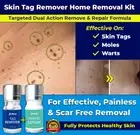 NEW SKIN TAG REMOVER LIQUID SAFE & FAST MOLE WART ACNE PIMPLE PATCH REMOVAL SPOT