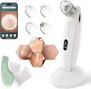Blackhead Remover Vacuum Pore Extractor for Face with Camera & Scraper Facial Cleanser Pore Vacuum Tools Kit for Men Women USB Wireless Charging 4 Suction Heads, 6 Adjustable Modes (White)