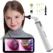Ear Camera Endoscope 3.9mm Wireless Otoscope 720P HD WiFi Ear Scope with 6 LED