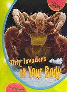 在飛比找三民網路書店優惠-Tiny Invaders in Your Body