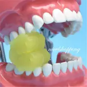 2X Dental Child Adult Bite Block Oral Opener Occlusal Pad Split Mouth Support