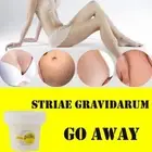 PASTEL pregnancy marks stretch marks scar remover Skin Cream Body Use Neu M6W8