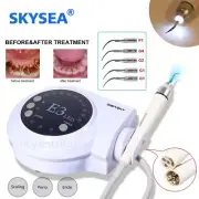 LED Dental Ultrasonic Piezo Scaler Handpiece 5 Tips Fit EMS Cavitron WOODPECKER