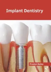 Implant Dentistry, Hardcover by Bailey, Preston (EDT), Brand New, Free shippi...
