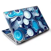 Skins for Lenovo Yoga 710 11" Decals wrap Mixed Blue Bubbles Glass