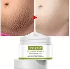 Say Goodbye to Stretch Marks with Our Powerful Fade Cream