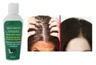 LM Glicolico Treatment / Exfoliating And Renewal Of The Scalp X 120ml.