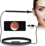 Jiusion 3.9mm Ultra-Thin Portable USB Digital Otoscope Camera with Carrying Case, HD 720P 6 LED Visual Ear Scope with 3 Hats 2 Silicone Caps 8 Earwax Spoons for Android Windows Mac NOT for iPhone iPad