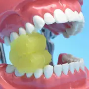 2x Yellow Dental Bite Block Occlusal Mouth Support Pad Split Opener Autoclavable