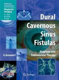 在飛比找三民網路書店優惠-Dural Cavernous Sinus Fistulas