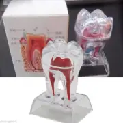 Plastic Emulational Dental Crystal Base Hard Plastic Teeth Tooth Molar Model AU