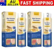 2Pcs Bee Venom Psoriasis Care Spray pro Anti-itching Psoriasis Treatment Spray