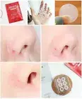 RIRE Red Spot Micro Needle 6 patches Anti Trouble Patch Acne & Blemish Treatment